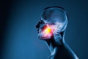 Head and Neck Injuries