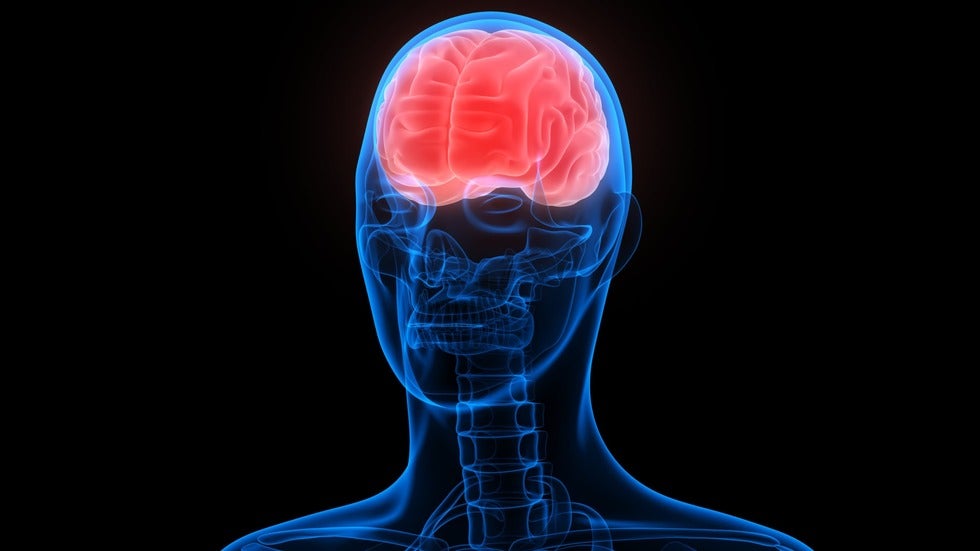 A traumatic brain injury (TBI) is an acute event that affects the brain, abruptly changing a person’s life. 