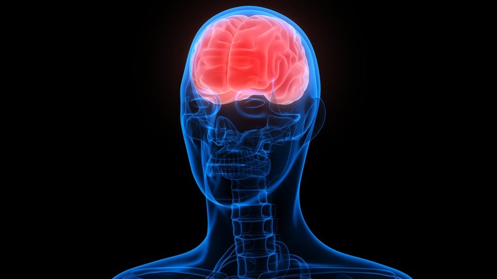 A traumatic brain injury (TBI) is an acute event that affects the brain, abruptly changing a person’s life.