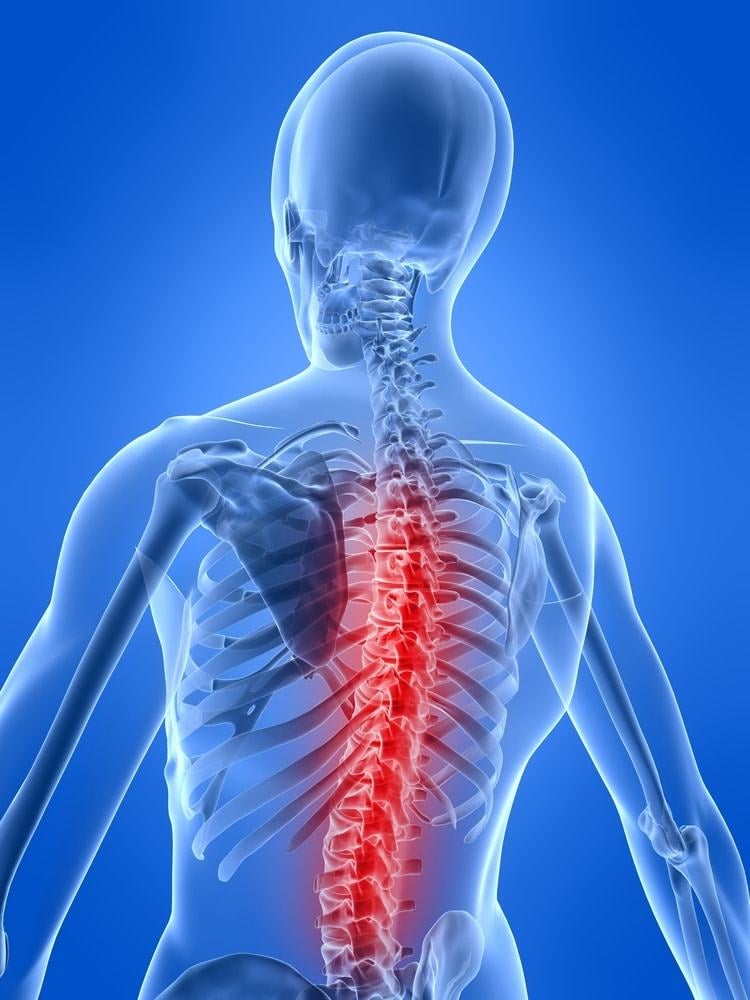 A herniated disc is a rupture of the spine’s vertebrae, causing back pain, and numbness or weakness in the arms and legs.