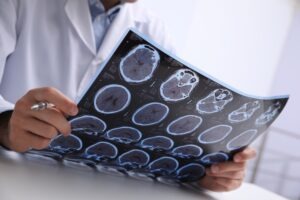 What Causes Traumatic Brain Injury?
